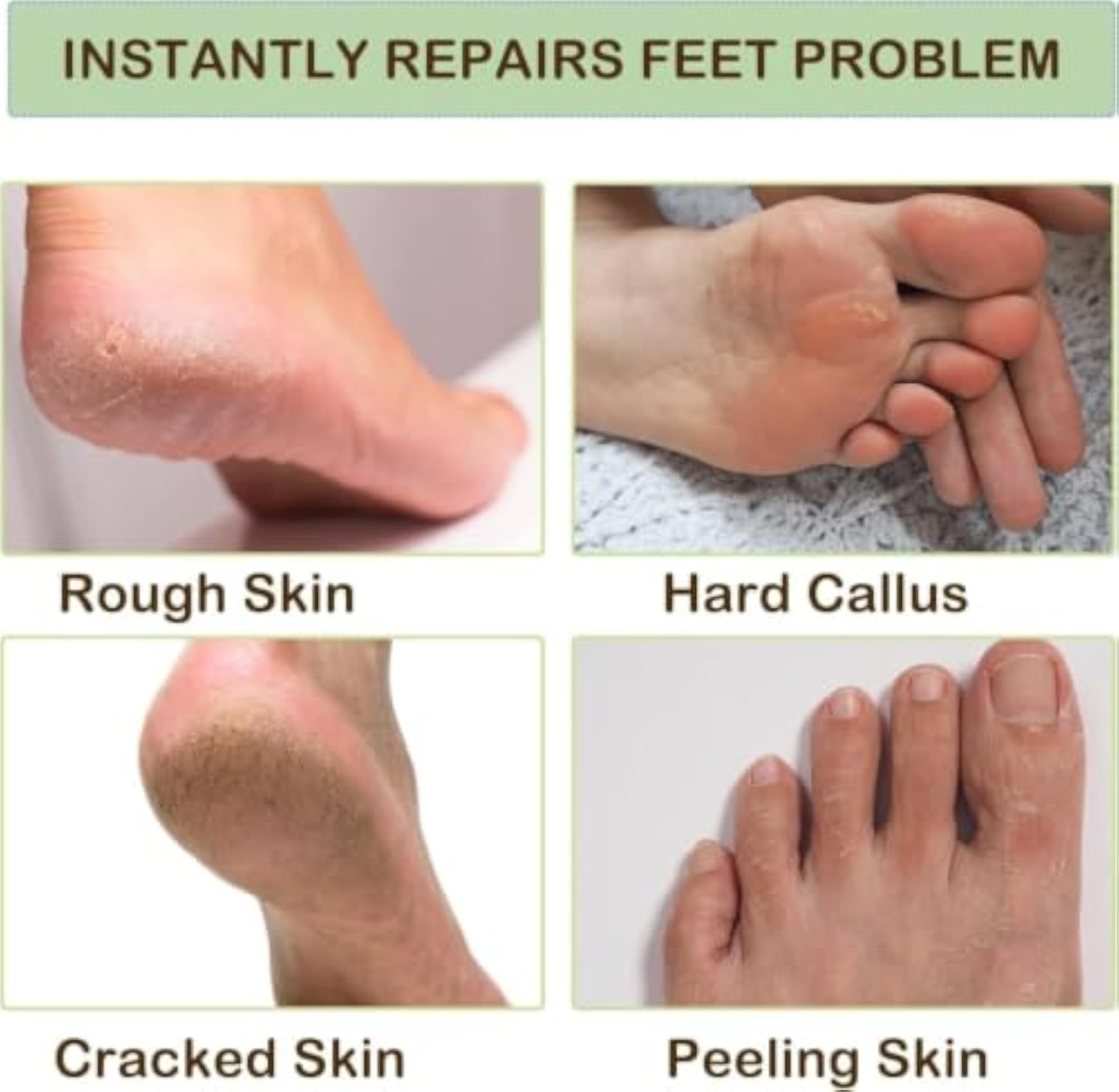 Silicone Moisturising Socks for Dry Feet and Heels, Reusable